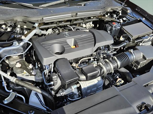 2025 Acura TLX Technology Package