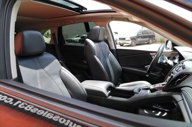 2019 Acura RDX Technology Package