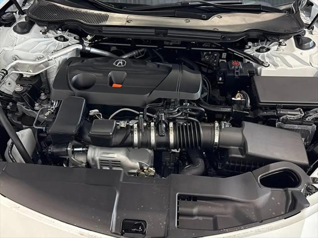 2025 Acura TLX A-SPEC Package