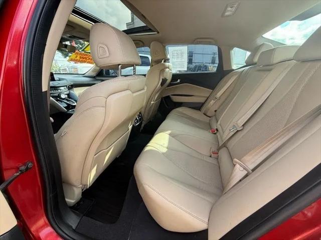 2021 Acura TLX Technology Package