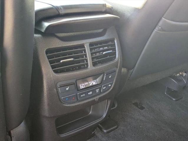 2016 Acura MDX Advance Package