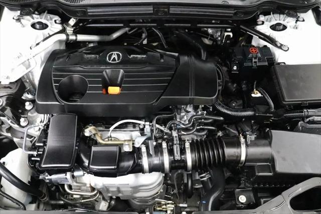 2025 Acura TLX Technology Package