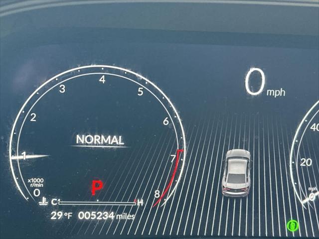 2025 Acura TLX Technology Package