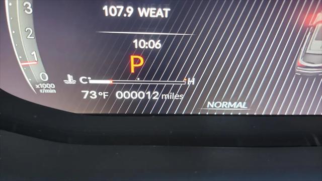 2026 Acura MDX Type S Advance Package