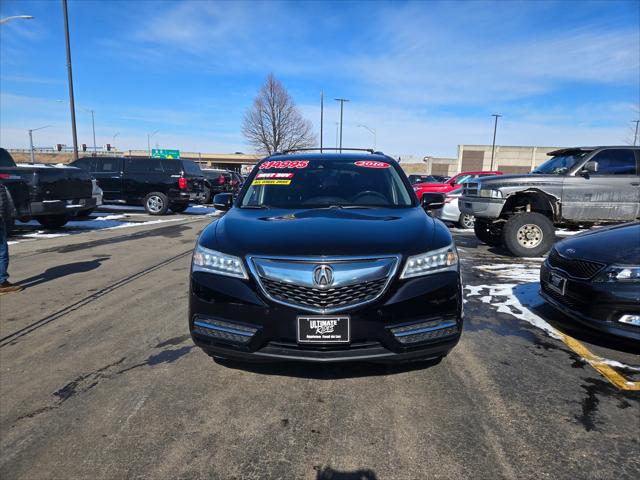 2016 Acura MDX Advance Package