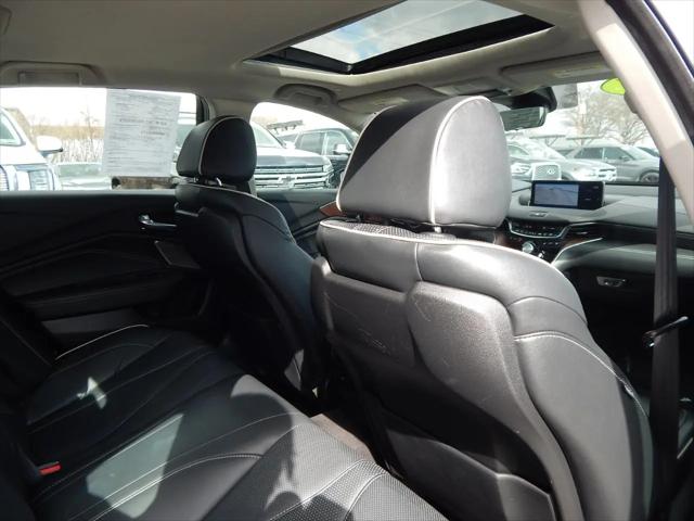2021 Acura TLX Advance Package