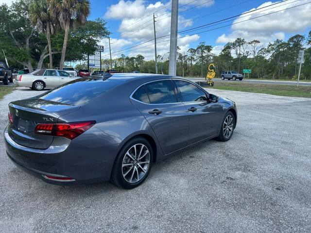 2017 Acura TLX w/Technology Package