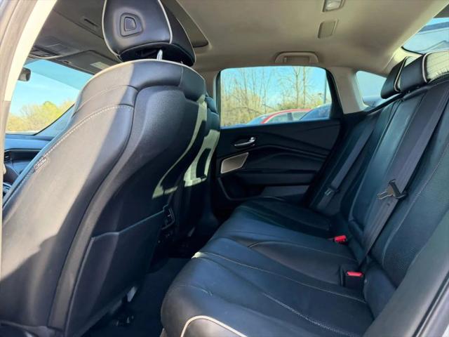 2021 Acura TLX Advance Package