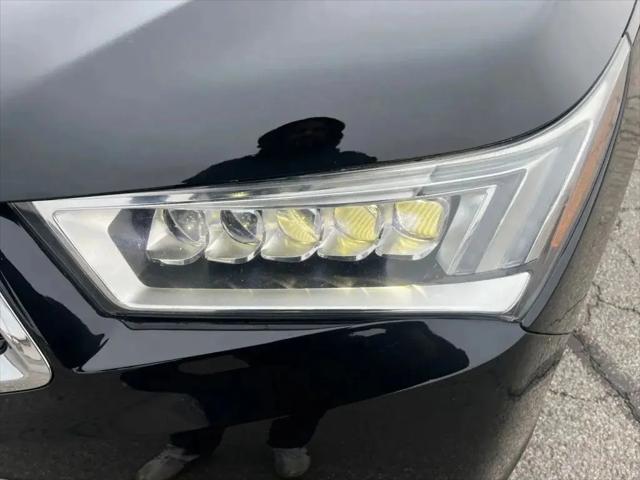 2017 Acura MDX w/Technology Package