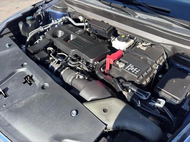 2022 Acura RDX Technology Package