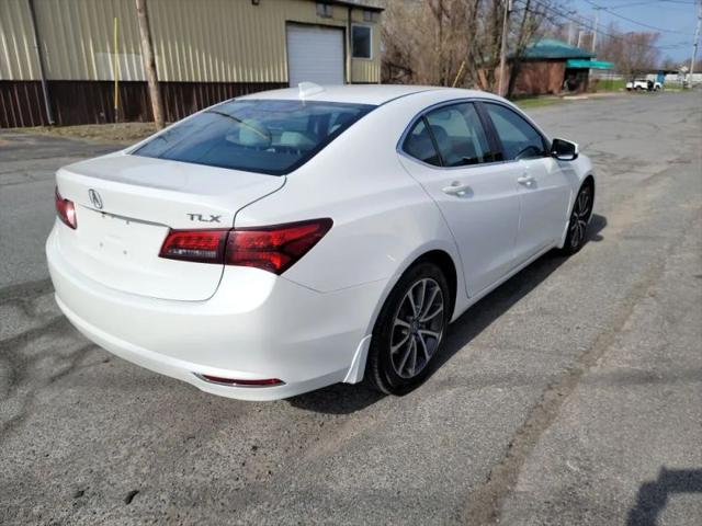 2017 Acura TLX w/Technology Package