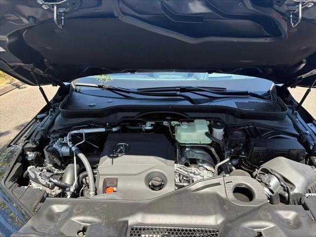 2026 Acura MDX Type S Advance Package