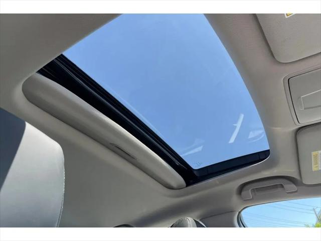 2025 Acura TLX Technology Package