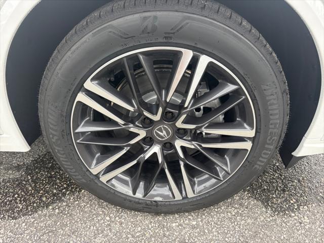 2026 Acura MDX Advance Package