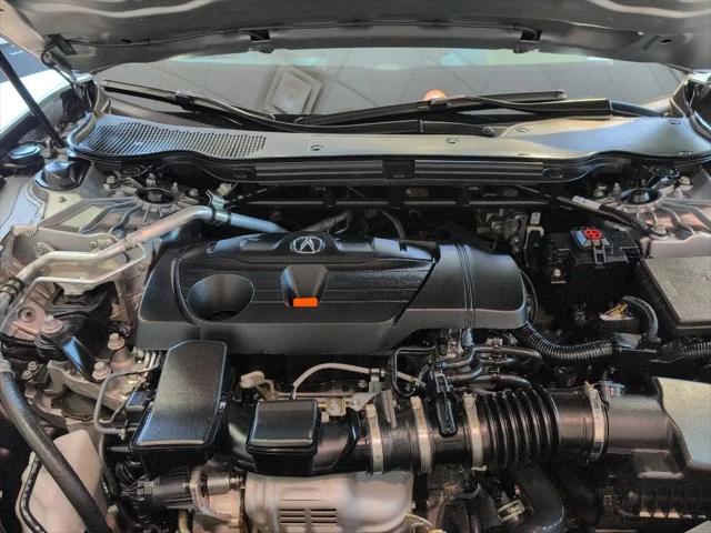 2025 Acura TLX Technology Package
