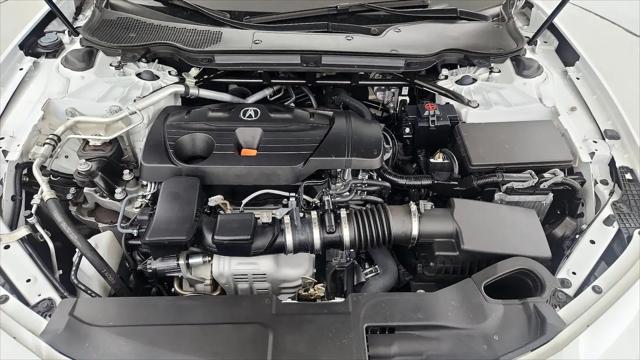 2025 Acura TLX Technology Package