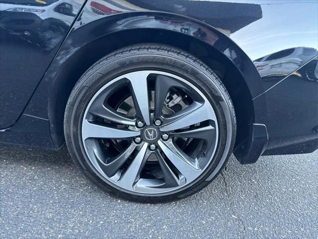 2025 Acura TLX Technology Package