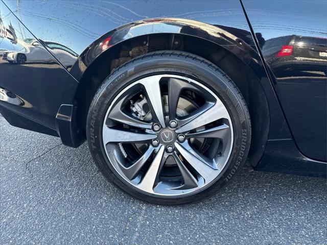 2025 Acura TLX Technology Package
