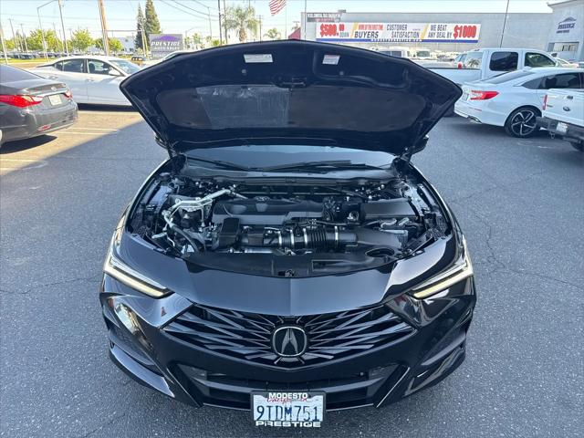 2025 Acura TLX Technology Package