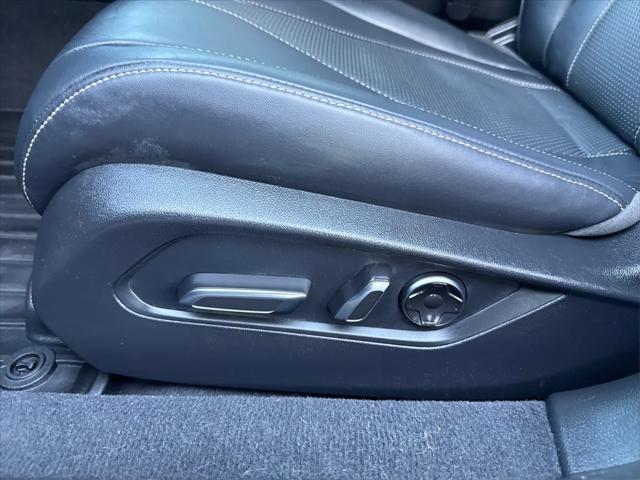 2025 Acura TLX Technology Package