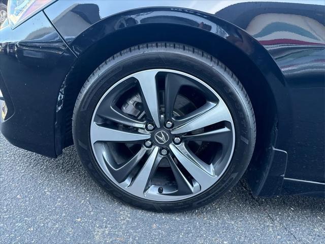 2025 Acura TLX Technology Package