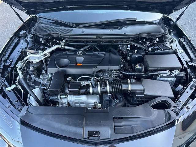 2025 Acura TLX Technology Package