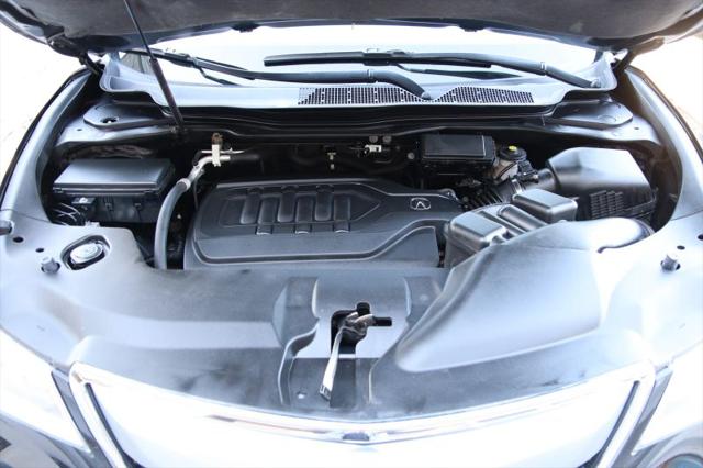 2016 Acura MDX Technology Package