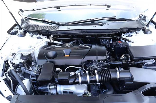 2024 Acura TLX Technology Package