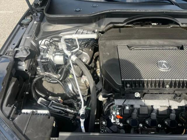 2022 Acura MDX Advance Package