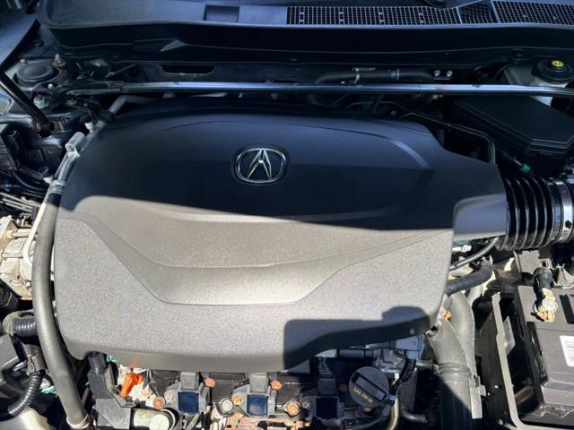 2015 Acura TLX V6