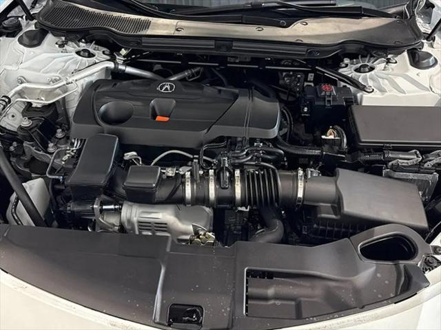 2025 Acura TLX Technology Package