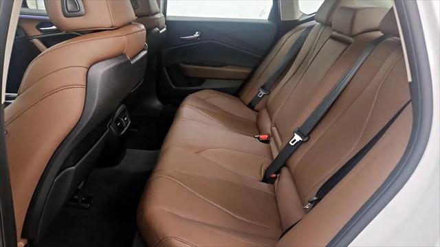 2021 Acura TLX Technology Package