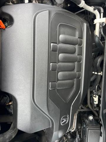 2015 Acura MDX Technology Package