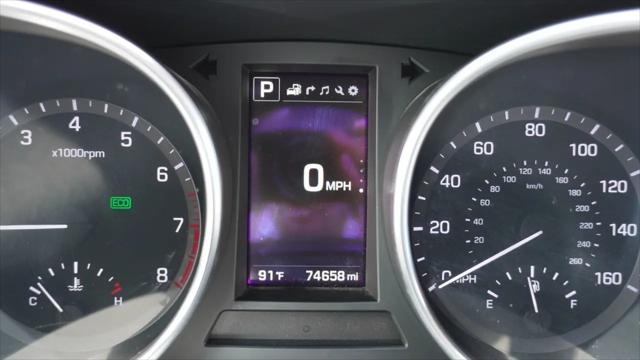2017 Hyundai Santa Fe SE Ultimate