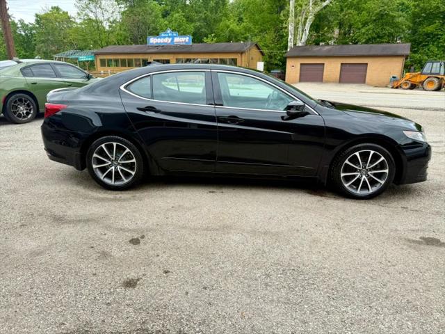2015 Acura TLX V6 Tech