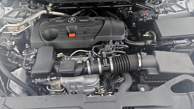 2025 Acura TLX A-SPEC Package