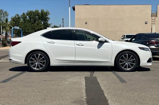 2017 Acura TLX w/Advance Package