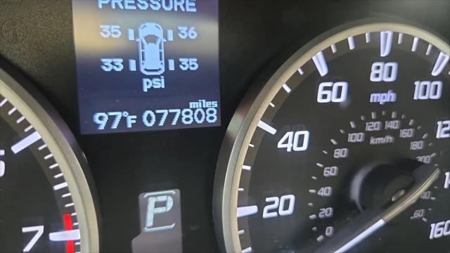 2017 Acura RDX w/Technology Package