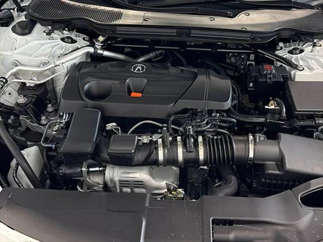 2025 Acura TLX A-SPEC Package