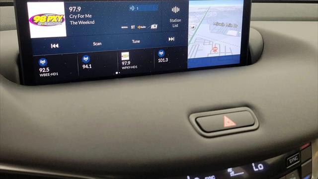 2025 Acura TLX Technology Package