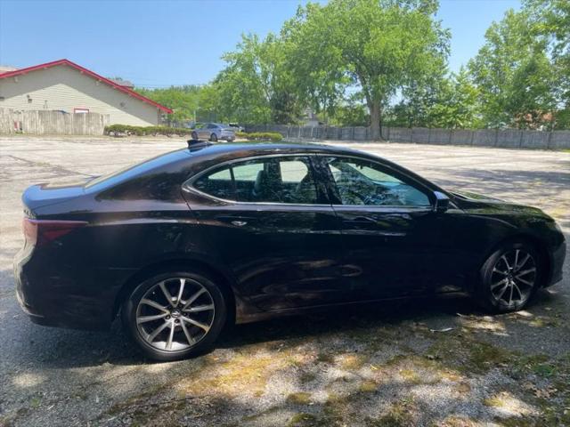 2015 Acura TLX V6 Advance