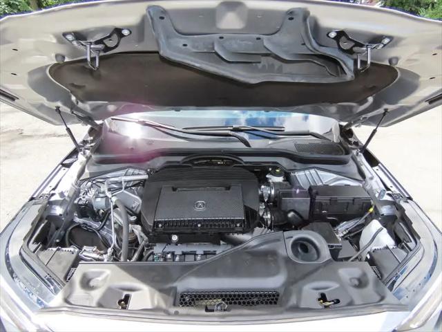 2024 Acura MDX Technology Package