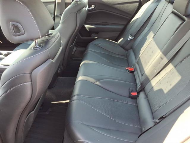 2021 Acura TLX Technology Package