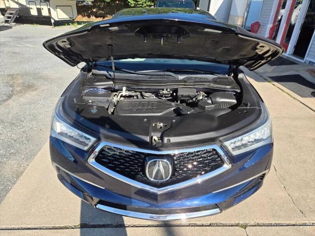 2017 Acura MDX w/Technology Package