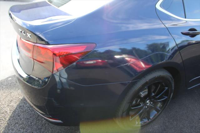 2015 Acura TLX V6 Tech