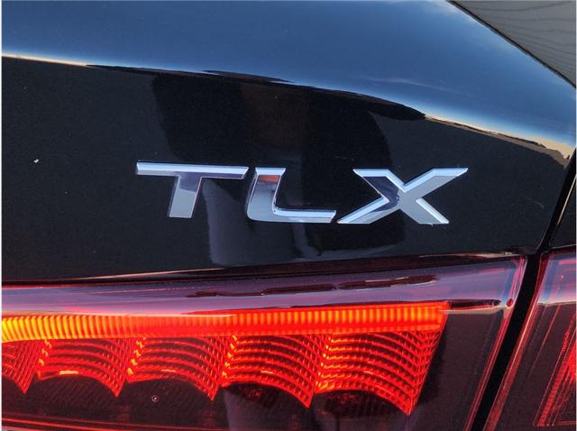 2017 Acura TLX w/Technology Package