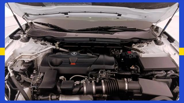 2021 Acura TLX Advance Package
